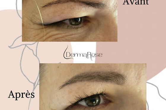 Dermarose - photo 1